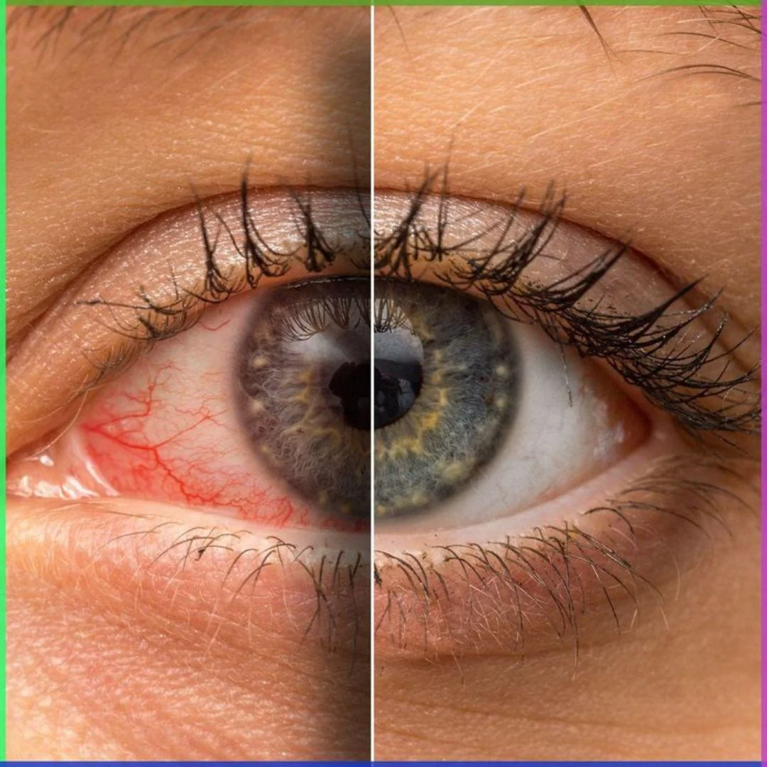 Common Eye Problems and How to Prevent Them